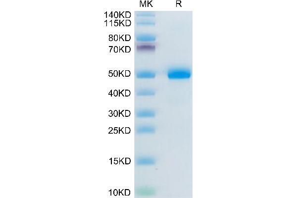 BAMBI Protein (AA 27-152) (Fc Tag)