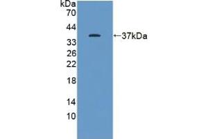 Western blot analysis of recombinant Human KEAP1. (KEAP1 抗体  (AA 327-624))