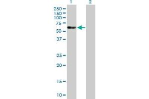 Western Blot analysis of EED expression in transfected 293T cell line by EED MaxPab polyclonal antibody. (EED 抗体  (AA 1-441))