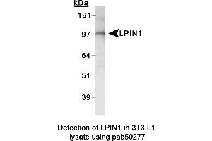 Image no. 2 for anti-Lipin 1 (LPIN1) (AA 300-400), (Internal Region) antibody (ABIN363586) (Lipin 1 抗体  (Internal Region))