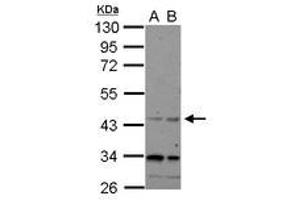 Image no. 1 for anti-CHRNA7 (Cholinergic Receptor, Nicotinic, alpha 7, Exons 5-10) and FAM7A (Family with Sequence Similarity 7A, Exons A-E) Fusion (CHRFAM7A) (AA 1-177) antibody (ABIN1497505)