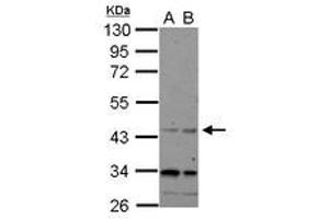 Image no. 1 for anti-CHRNA7 (Cholinergic Receptor, Nicotinic, alpha 7, Exons 5-10) and FAM7A (Family with Sequence Similarity 7A, Exons A-E) Fusion (CHRFAM7A) (AA 1-177) antibody (ABIN1497505) (CHRFAM7A 抗体  (AA 1-177))