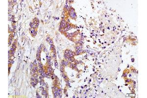 Immunohistochemistry (Paraffin-embedded Sections) (IHC (p)) image for anti-TIMP Metallopeptidase Inhibitor 1 (TIMP1) (AA 103-207) antibody (ABIN668331)