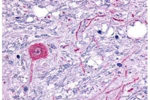 Anti-HTR6 / 5-HT6 antibody  ABIN1048968 IHC staining of human brain, neuron. (Serotonin Receptor 6 抗体  (C-Term))