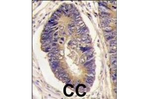 Immunohistochemistry (Paraffin-embedded Sections) (IHC (p)) image for anti-Protein tyrosine Phosphatase, Non-Receptor Type 3 (PTPN3) (AA 366-397) antibody (ABIN392839)