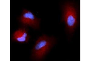 Immunofluorescence (IF) image for anti-Cystatin SN (CST1) (AA 21-141) antibody (APC) (ABIN5568436) (CST1 抗体  (AA 21-141) (APC))