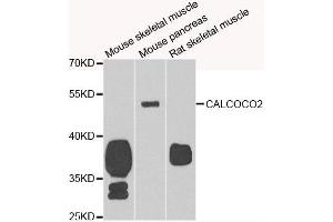 Western blot analysis of extracts of various cell lines, using CALCOCO2 antibody. (CALCOCO2 抗体)