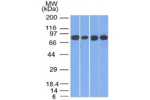 Western Blot of HT20, A549, 293 and A431 cell lysates using C Catenin, gamma Mouse Monoclonal Antibody (11E4). (JUP 抗体)