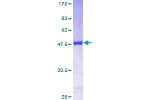 Transgelin 3 (TAGLN3) (AA 1-199) protein (GST tag)