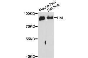 Western blot analysis of extracts of various cell lines, using HAL antibody.