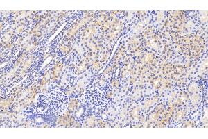 Detection of GSS in Human Kidney Tissue using Polyclonal Antibody to Glutathione Synthetase (GSS) (Glutathione Synthetase 抗体  (AA 268-474))