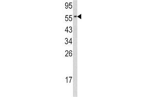 Western Blotting (WB) image for anti-Cell Division Cycle 23 (CDC23) antibody (ABIN3002712) (CDC23 抗体)