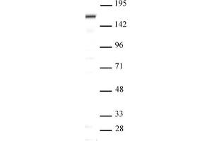SIP1 antibody (pAb) tested by Western blot Nuclear extract of Saos-2 cells (20 μg per lane) probed with SIP1 antibody (pAb) at a dilution of 1:500. (SIP1 抗体  (N-Term))