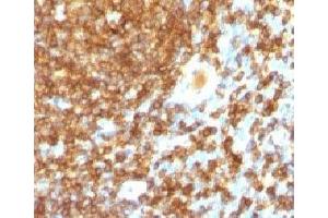 IHC test of FFPE human tonsil probed with CD45RB antibody (PTPRC/1132). (CD45RB 抗体)
