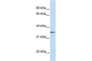 WB Suggested Anti-GNB1 Antibody Titration: 0. (GNB1 抗体  (C-Term))