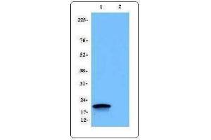 Western Blotting (WB) image for anti-CD247 Molecule (CD247) antibody (ABIN2664434) (CD247 抗体)