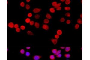 Immunofluorescence analysis of HeLa cells using CYBA Polyclonal Antibody at dilution of 1:100 (40x lens). (CYBA 抗体)