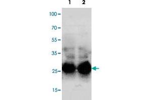 Western blot analysis of mouse lung with Sftpa1 polyclonal antibody . (Surfactant Protein A1 抗体  (C-Term))