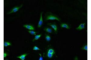 Immunofluorescent analysis of A549 cells using ABIN7166257 at dilution of 1:100 and Alexa Fluor 488-congugated AffiniPure Goat Anti-Rabbit IgG(H+L) (UNC5 (AA 15-82) 抗体)
