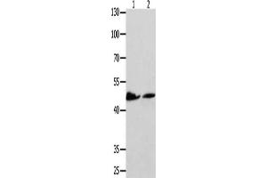 Gel: 10 % SDS-PAGE, Lysate: 40 μg, Lane 1-2: Hela cells, 293T cells, Primary antibody: ABIN7191756(P2RY11 Antibody) at dilution 1/500, Secondary antibody: Goat anti rabbit IgG at 1/8000 dilution, Exposure time: 1 minute