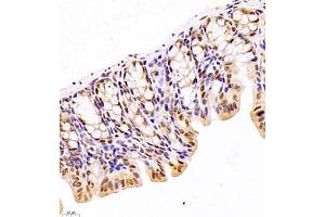 Immunohistochemistry (Paraffin-embedded Sections) (IHC (p)) image for anti-General Transcription Factor IIIC, Polypeptide 2, beta 110kDa (GTF3C2) antibody (ABIN7074038)
