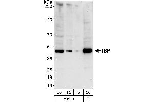 Western Blotting (WB) image for anti-TATA Box Binding Protein (TBP) (AA 1-50) antibody (ABIN7453215)