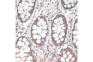 Immunohistochemistry of paraffin-embedded human colon using APC antibody (ABIN1678689, ABIN1678690, ABIN5664154 and ABIN6219837) at dilution of 1:200 (40x lens).
