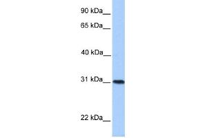 WB Suggested Anti-HELT Antibody Titration:  0. (HELT 抗体  (Middle Region))