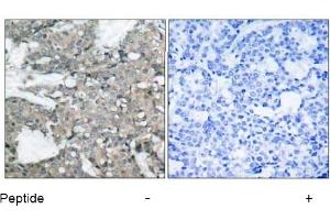 Image no. 1 for anti-Mitogen-Activated Protein Kinase Kinase 1 (MAP2K1) (Ser221) antibody (ABIN197388)