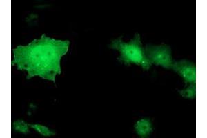 Anti-TOMM34 mouse monoclonal antibody (ABIN2454814) immunofluorescent staining of COS7 cells transiently transfected by pCMV6-ENTRY TOMM34 (RC201083). (TOMM34 抗体)