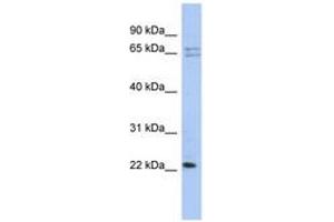 Image no. 1 for anti-Ribosomal Protein L18 (RPL18) (N-Term) antibody (ABIN6743981) (RPL18 抗体  (N-Term))