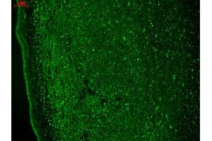 Immunohistochemistry analysis using Mouse Anti-CaV3. (CACNA1H 抗体  (AA 1019-1293) (APC))