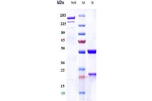 Anti-CDH3 / P-cadherin Reference Antibody (PF-03732010) on SDS-PAGE under reducing (R) condition.