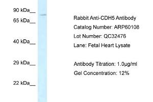 Western Blotting (WB) image for anti-Cadherin 5 (CDH5) (Middle Region) antibody (ABIN2788335) (Cadherin 5 抗体  (Middle Region))
