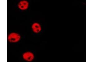 ABIN6277198 staining HepG2 by IF/ICC.