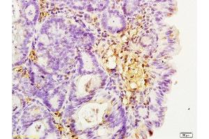 Formalin-fixed and paraffin embedded rat colitis tissue labeled with Anti-Integrin β2/CD18/LFA-1 Polyclonal Antibody, Unconjugated  at 1:200, followed by conjugation to the secondary antibody and DAB staining (Integrin beta 2 抗体  (AA 701-770))