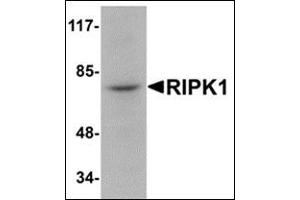 Western blot analysis of RIPK1 in rat kidney tissue lysate with this product at 1 μg/ml.