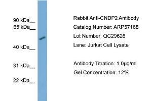 WB Suggested Anti-CNDP2  Antibody Titration: 0. (CNDP2 抗体  (Middle Region))