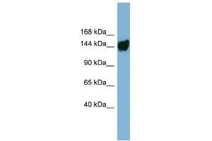 Human ACHN; WB Suggested Anti-AASDH Antibody Titration: 0. (AASDH 抗体  (Middle Region))