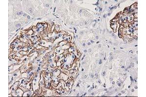 Immunohistochemical staining of paraffin-embedded Human Kidney tissue using anti-PDLIM2 mouse monoclonal antibody. (PDLIM2 抗体)