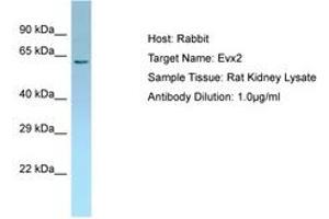 Image no. 1 for anti-Homeobox even-skipped homolog protein 2 (EVX2) (AA 51-100) antibody (ABIN6749824) (EVX2 抗体  (AA 51-100))