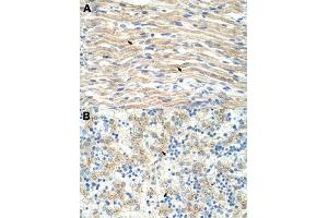 Immunohistochemical staining (Formalin-fixed paraffin-embedded sections) of human muscle (A) and human liver (B) with EXOSC6 polyclonal antibody  at 4-8 ug/mL working concentration. (EXOSC6 抗体  (N-Term))
