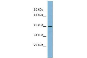Western Blot showing ETV3L antibody used at a concentration of 1-2 ug/ml to detect its target protein. (ETV3L 抗体  (Middle Region))