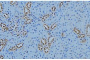 ABIN6279098 at 1/100 staining Mouse kidney tissue by IHC-P. (AGXT2 抗体  (Internal Region))
