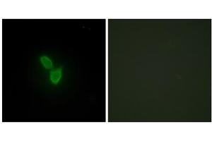 Immunofluorescence analysis of HepG2 cells, using PARD3 antibody. (PARD3 抗体  (C-Term))