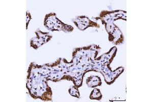 IHC analysis of TRBP/TARBP2 using anti-TRBP/TARBP2 antibody (ABIN7600548).