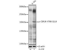 Western blot analysis of extracts of K-562 cells, using Phospho-CSF1R-Y708 antibody (ABIN6135205, ABIN6136052, ABIN6136053 and ABIN6225625) at 1:1000 dilution. (CSF1R 抗体  (pTyr708))