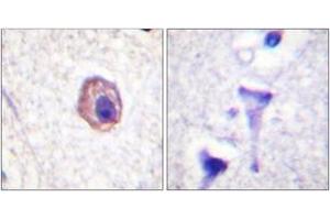 Immunohistochemistry analysis of paraffin-embedded human brain tissue, using MRLC2 (Ab-18) Antibody. (MYL12B 抗体  (AA 3-52))