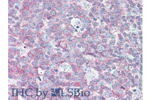 Immunohistochemistry (IHC) image for anti-Lymphocyte Antigen 9 (CD229) (AA 384-642) antibody (ABIN7438622)