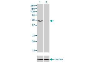 Western blot analysis of C9orf98 over-expressed 293 cell line, cotransfected with C9orf98 Validated Chimera RNAi (Lane 2) or non-transfected control (Lane 1). (AK8 抗体  (AA 381-479))